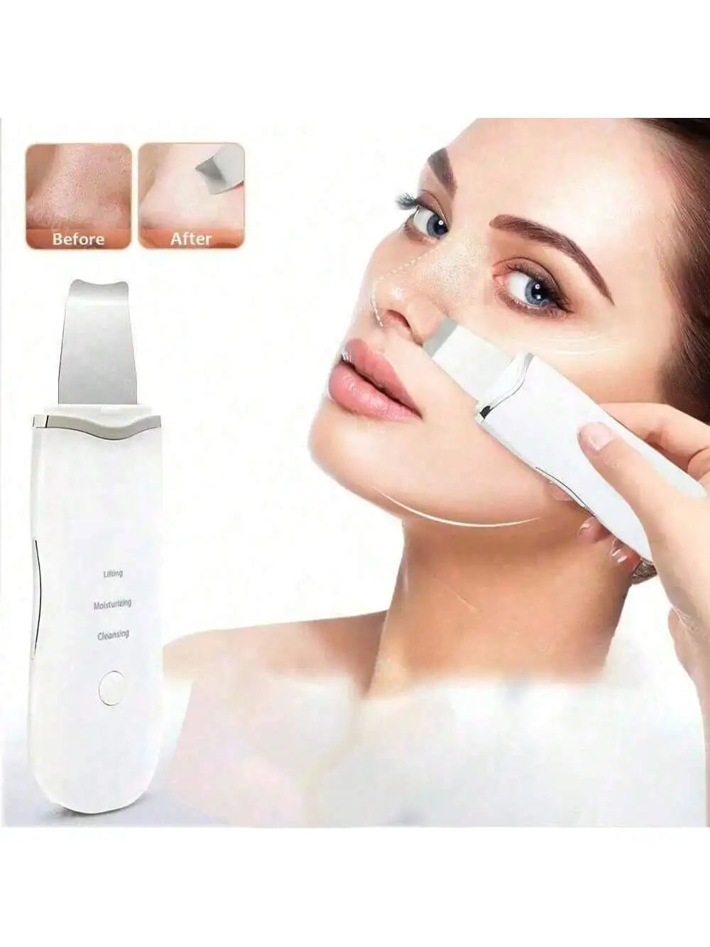 MassagePro™ - Ultrasonic Face Scrubber