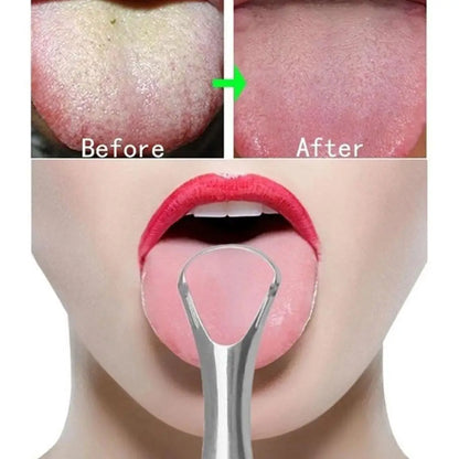 FreshSmile™ Tongue Scraper Fresh Breath Maker