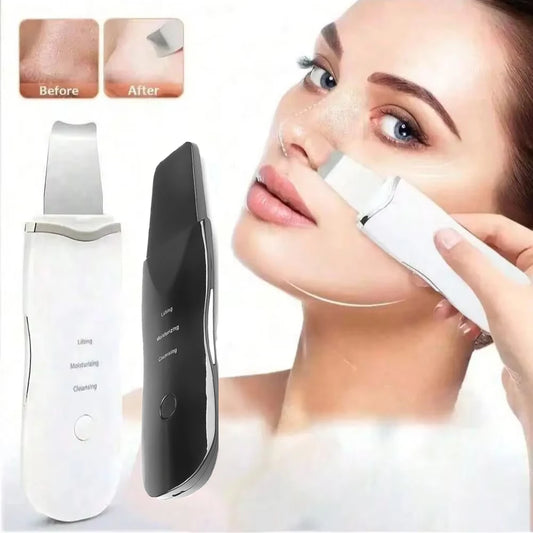 MassagePro™ - Ultrasonic Face Scrubber