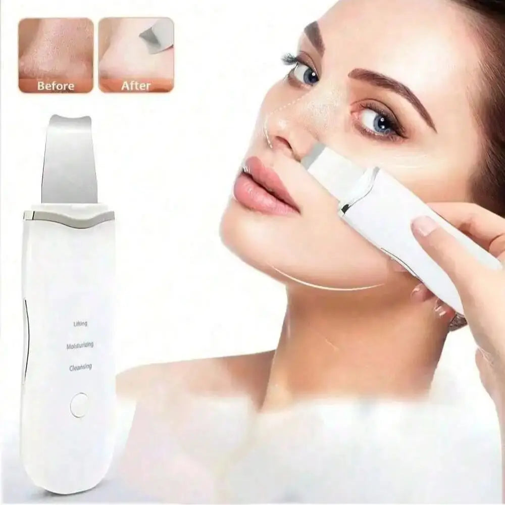 MassagePro™ - Ultrasonic Face Scrubber